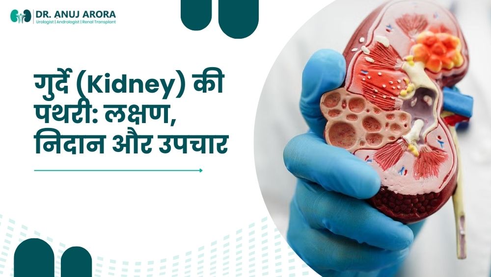 गुर्दे (Kidney) की पथरी