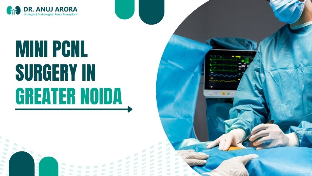 Mini PCNL Surgery in Greater Noida 