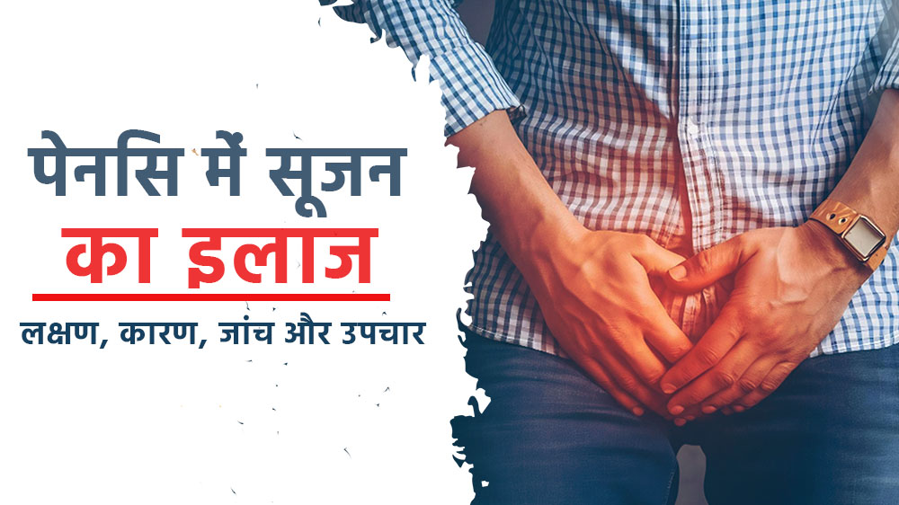पेनिस (लिंग) में सूजन का इलाज