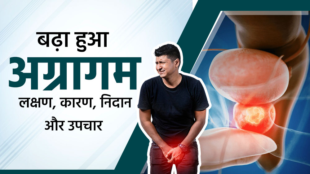 बढ़ा हुआ अग्रागम