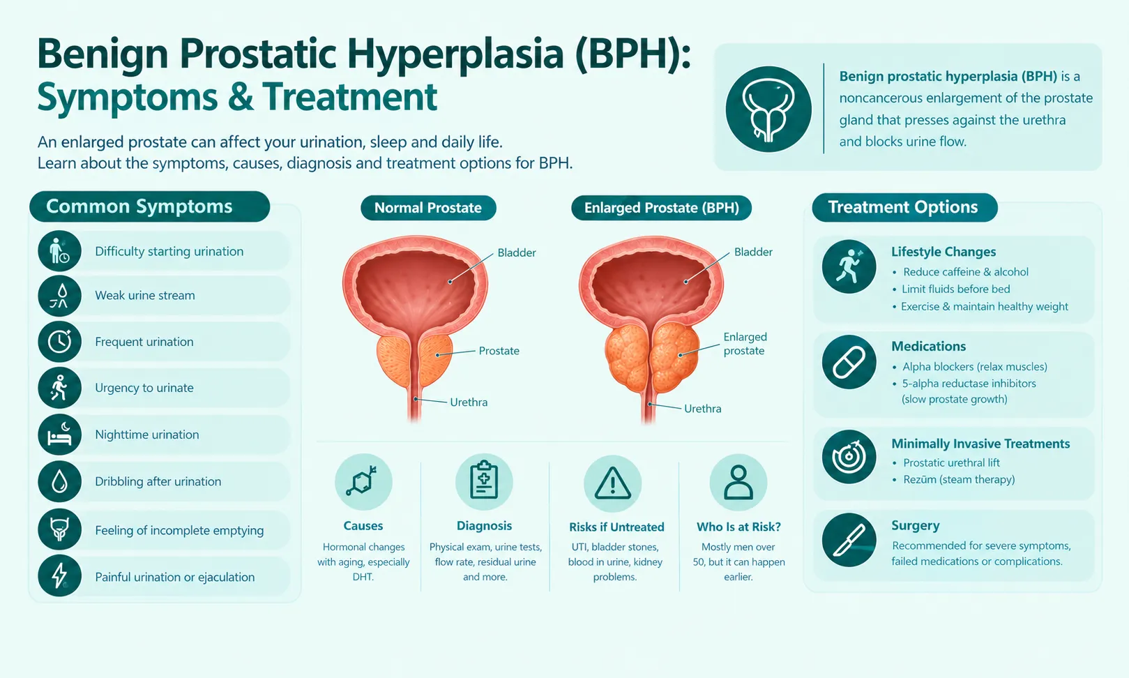 Benign Prostatic Hyperplasia (BPH): Symptoms & Treatment