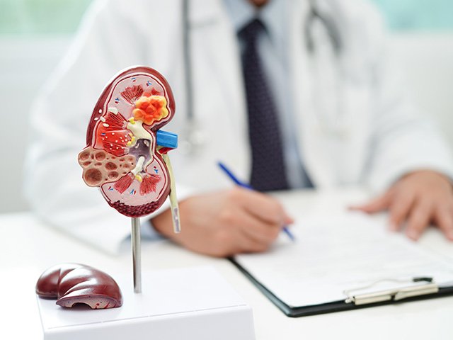 Kidney Stone Treatment in Noida 