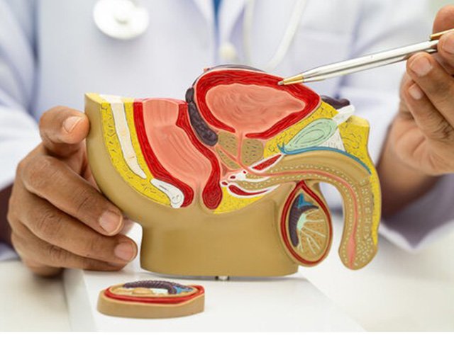 Prostatitis Treatment in Noida