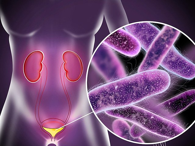 Urinary Infection Treatment in Noida