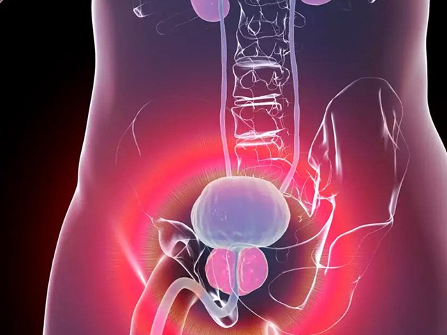 Enlarged Prostate (BPH) Treatment In Noida