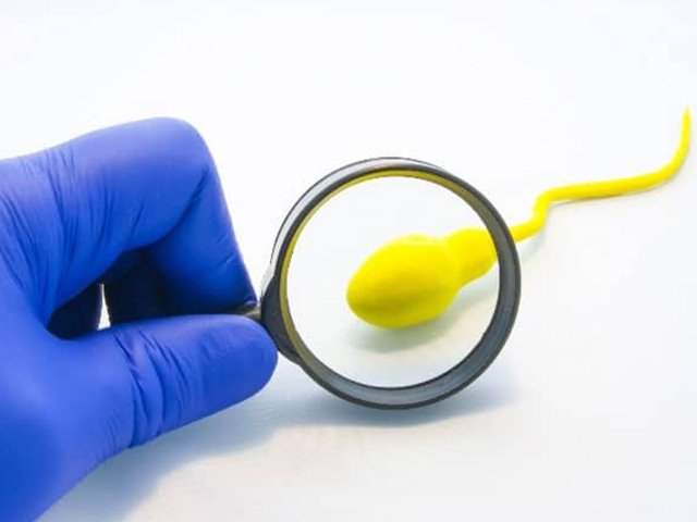 Male Infertility Treatment In Noida