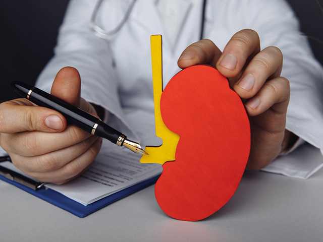 Best Doctor For PUJ Obstruction in Noida 