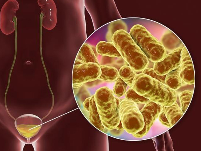 Best Doctor For Urinary Infection in Noida