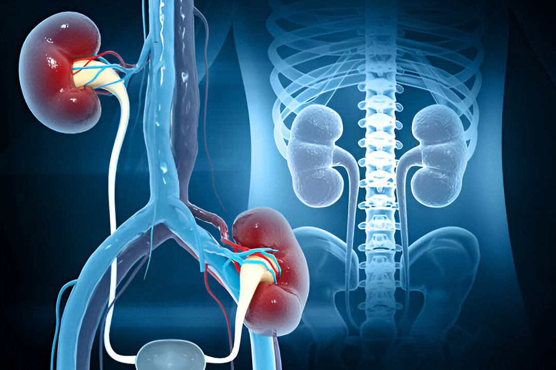 UTI Treatment and Diagnosis Procedure