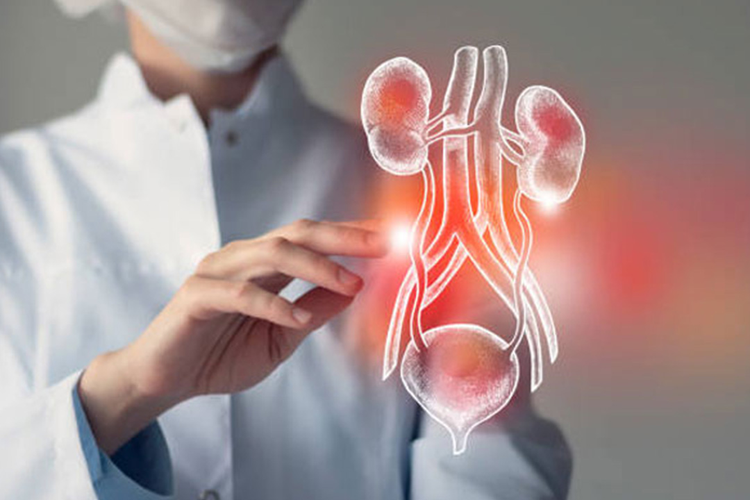 Urological Cancers Procedure