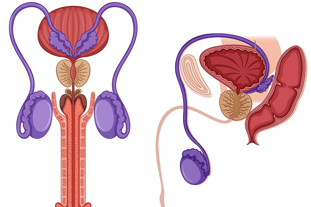Procedure for Varicocele Treatment